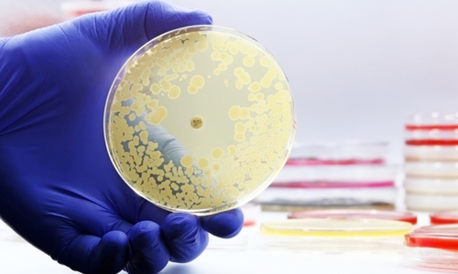 EFSA: un rapporto sull’importanza di ridurre l’uso di antibiotici