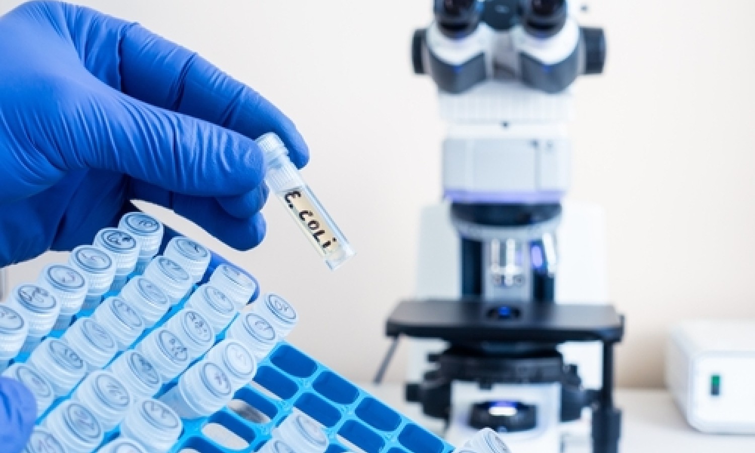 Il rischio microbiologico da Escherichia coli 