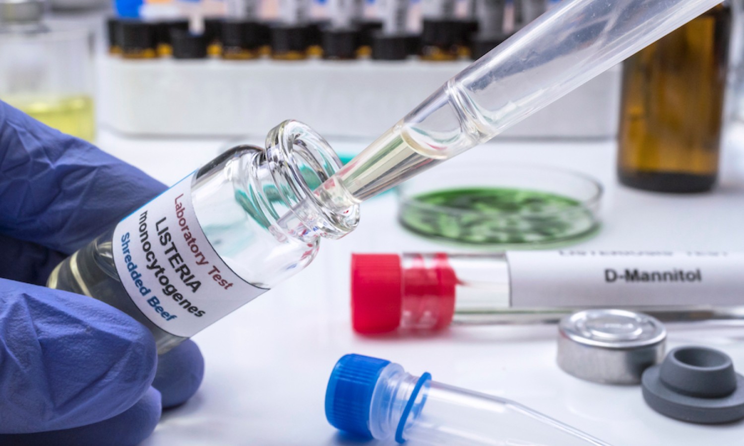 Monitoraggio Listeria ed Escherichia coli negli alimenti pronti al consumo